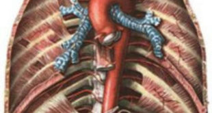 aortit-sifiliticheskij-simptomy