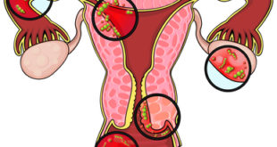 Section of female reproductive system and germs on different parts