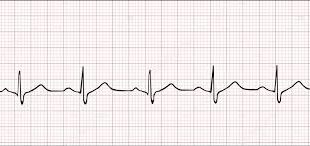 kardiogramma