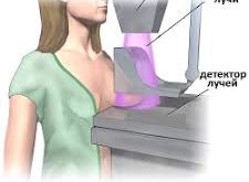 mamografiya